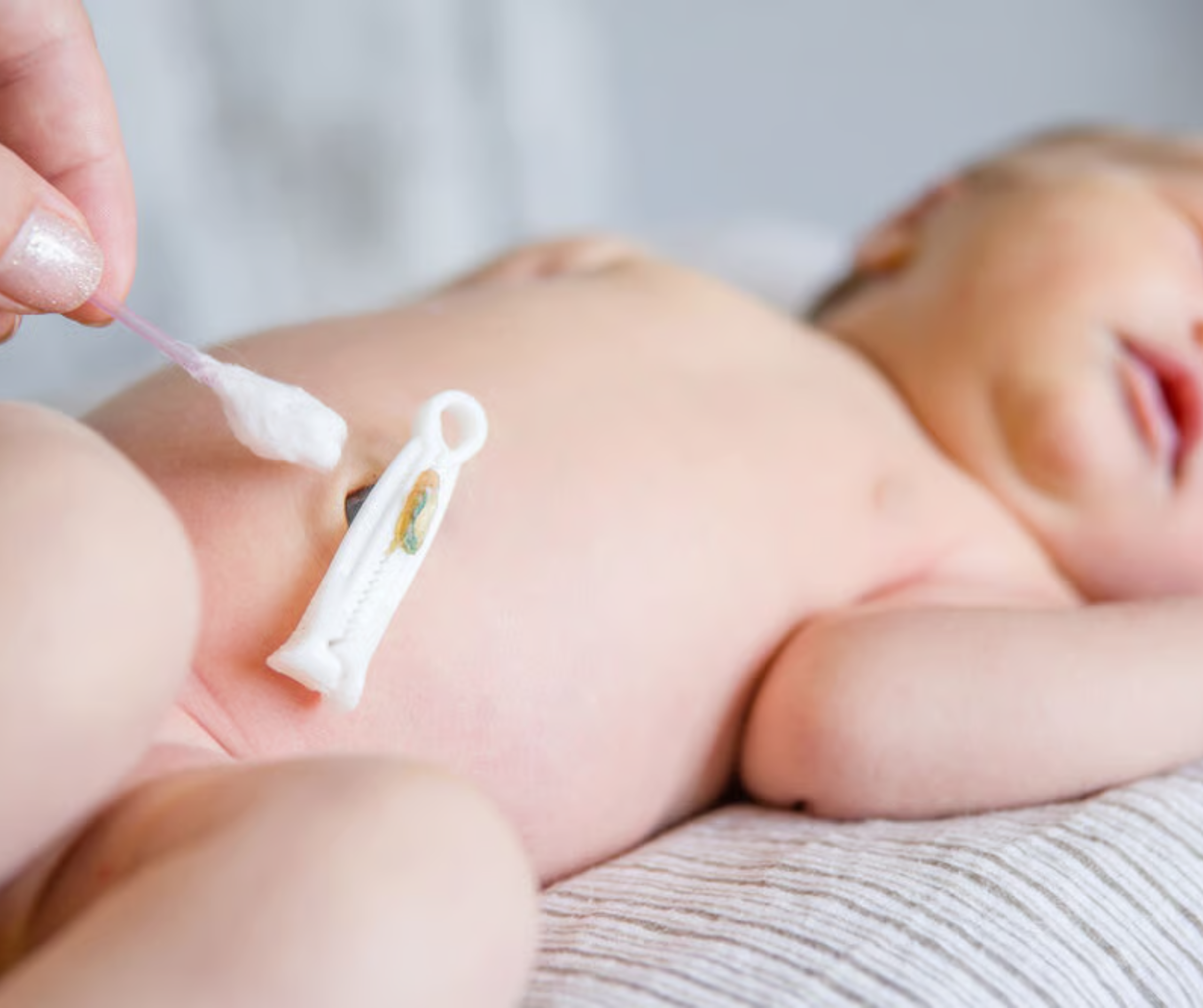 cách chăm sóc rốn trẻ sơ sinh 