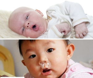 phân biệt nghẹt mũi và khó thở ở trẻ sơ sinh
